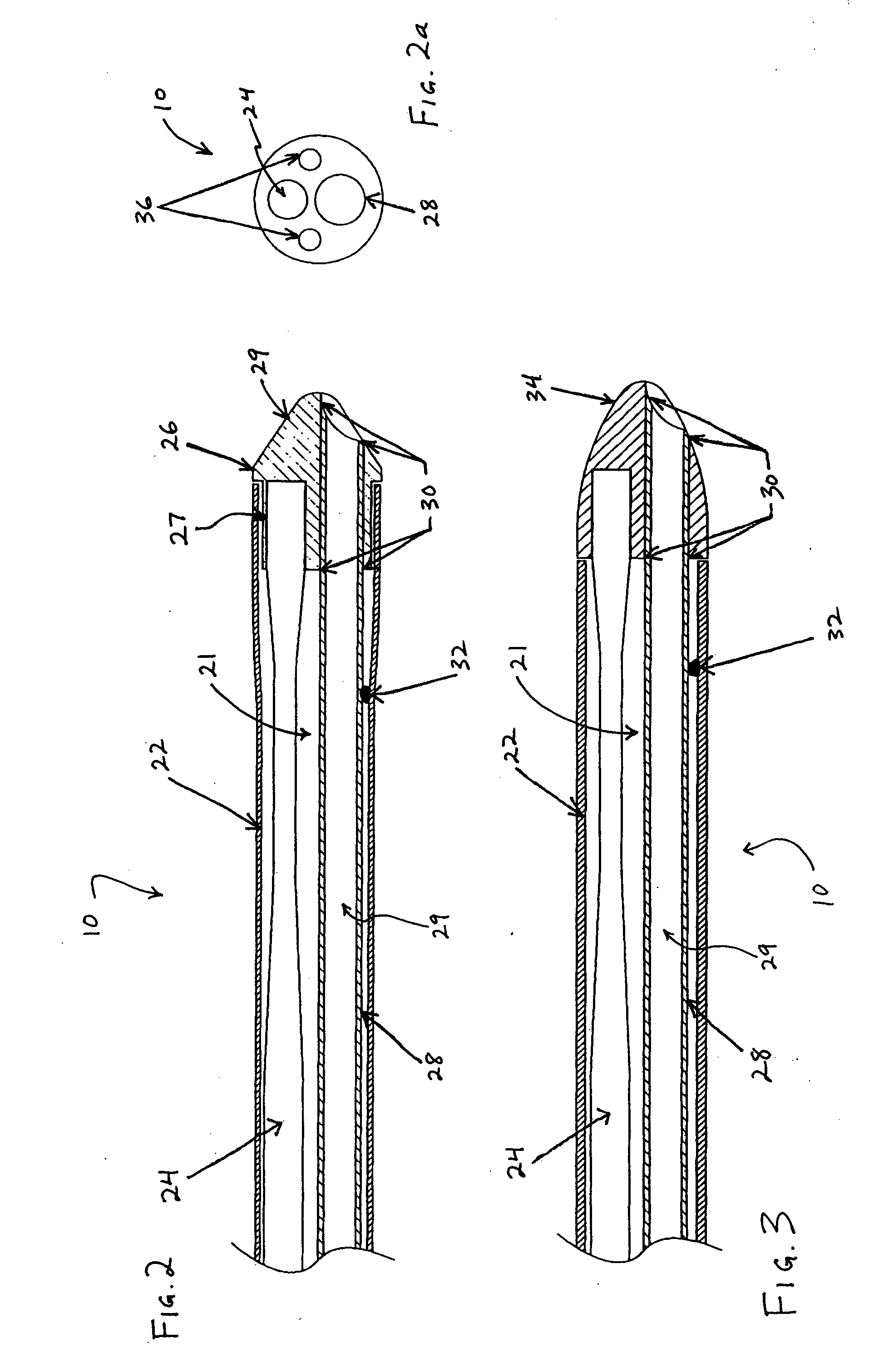 Ultrasound catheter for disrupting blood vessel obstructions