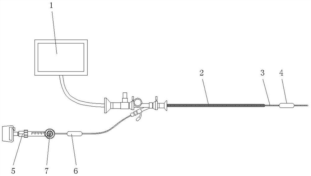 Visual urethra dilatation kit