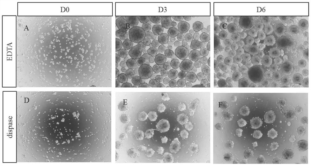 A method for obtaining retinal-like tissue rich in cones and rods by using human induced pluripotent stem cells