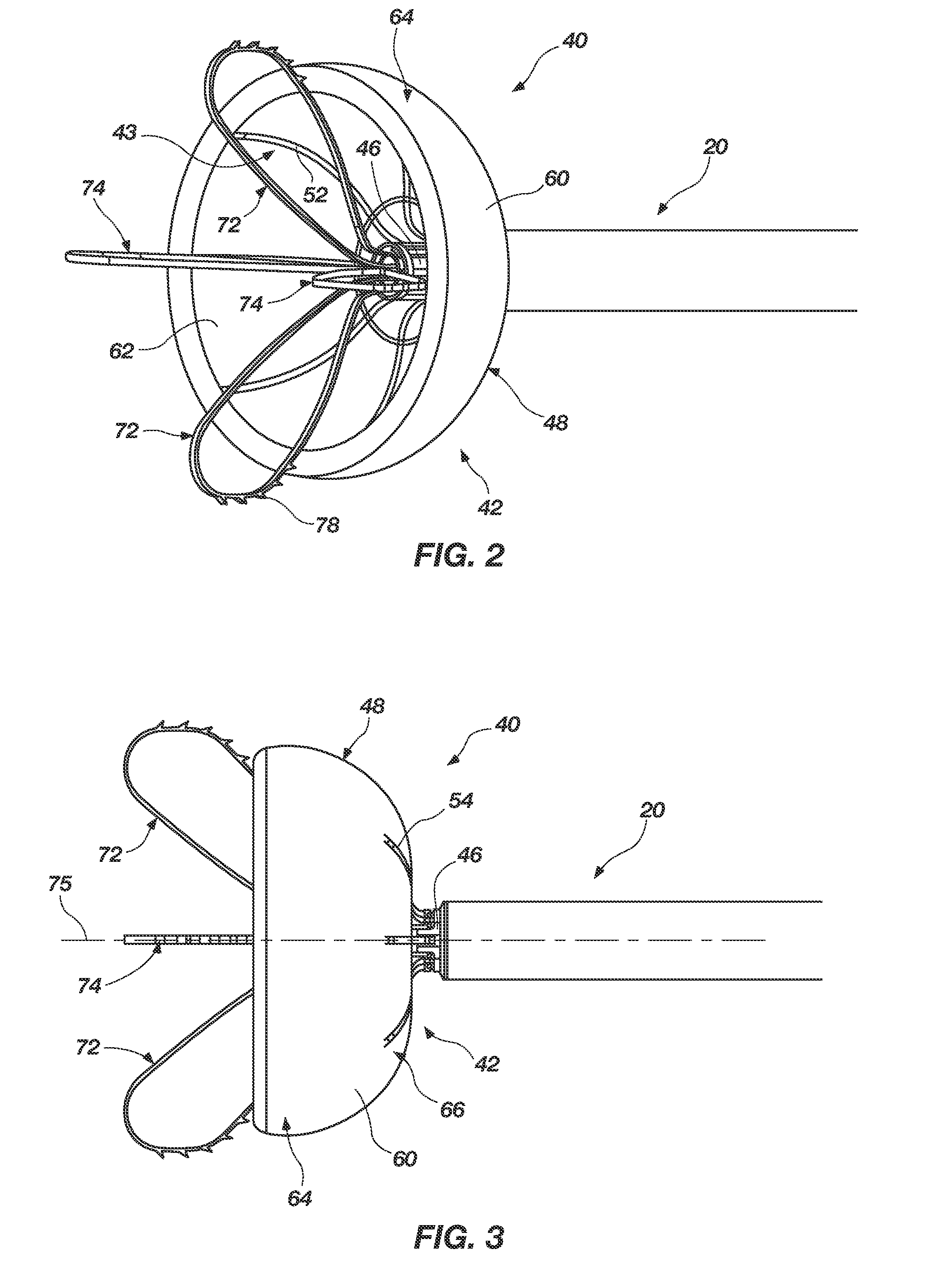 Medical device for modification of left atrial appendage and related systems and methods