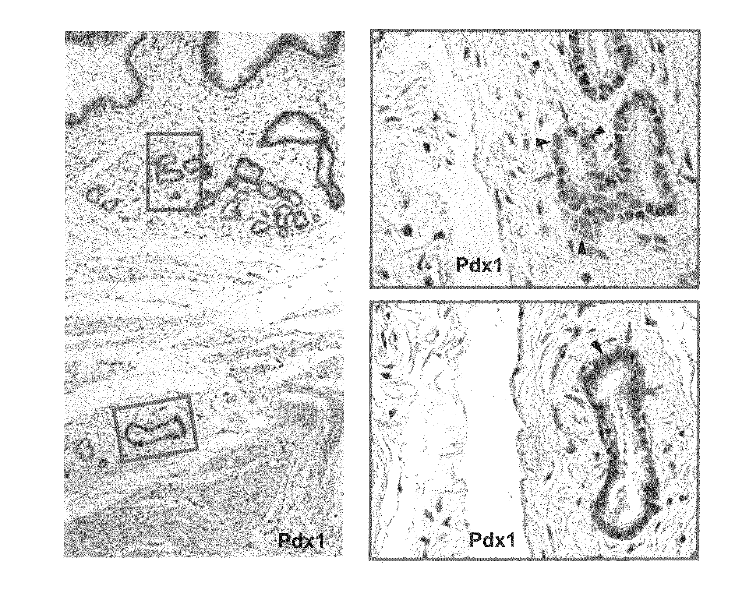 Multipotent stem cells from the extrahepatic biliary tree and methods of isolating same