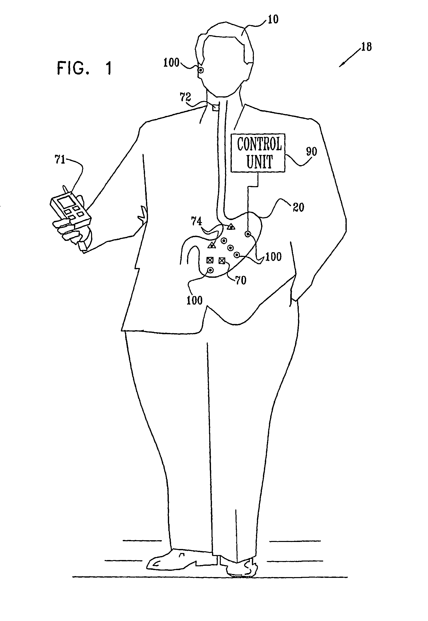 Wireless leads for gastrointestinal tract applications