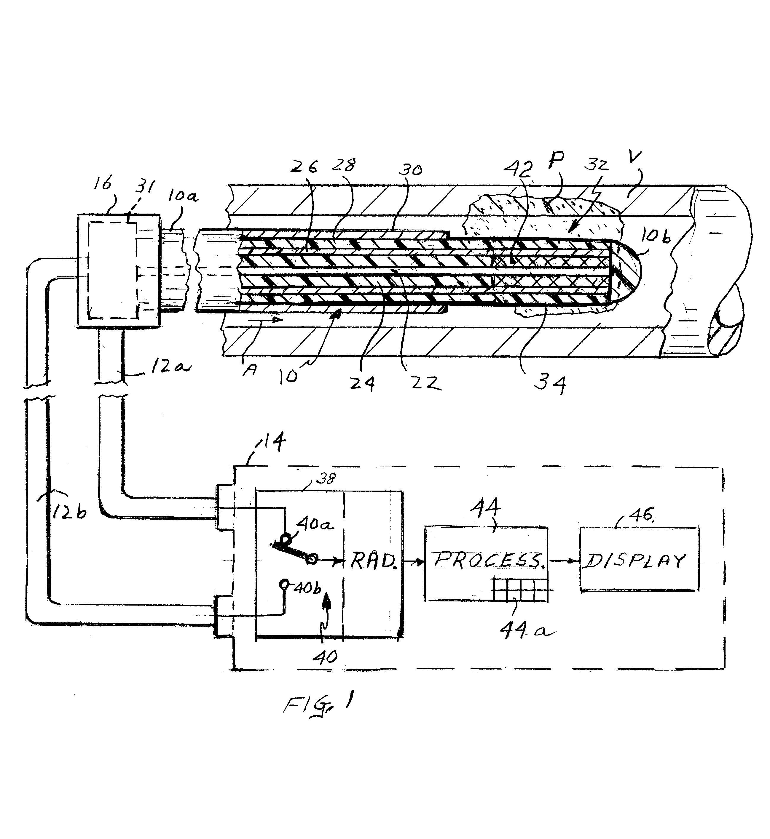 Method and apparatus for detecting and treating vulnerable plaques