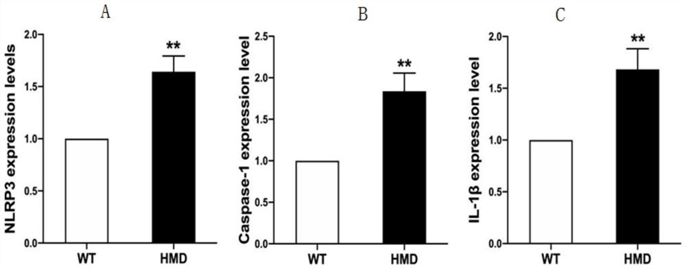 Application of product for detecting TRPC6 gene or expression product thereof