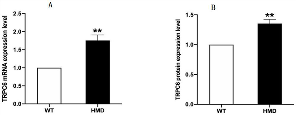 Application of product for detecting TRPC6 gene or expression product thereof