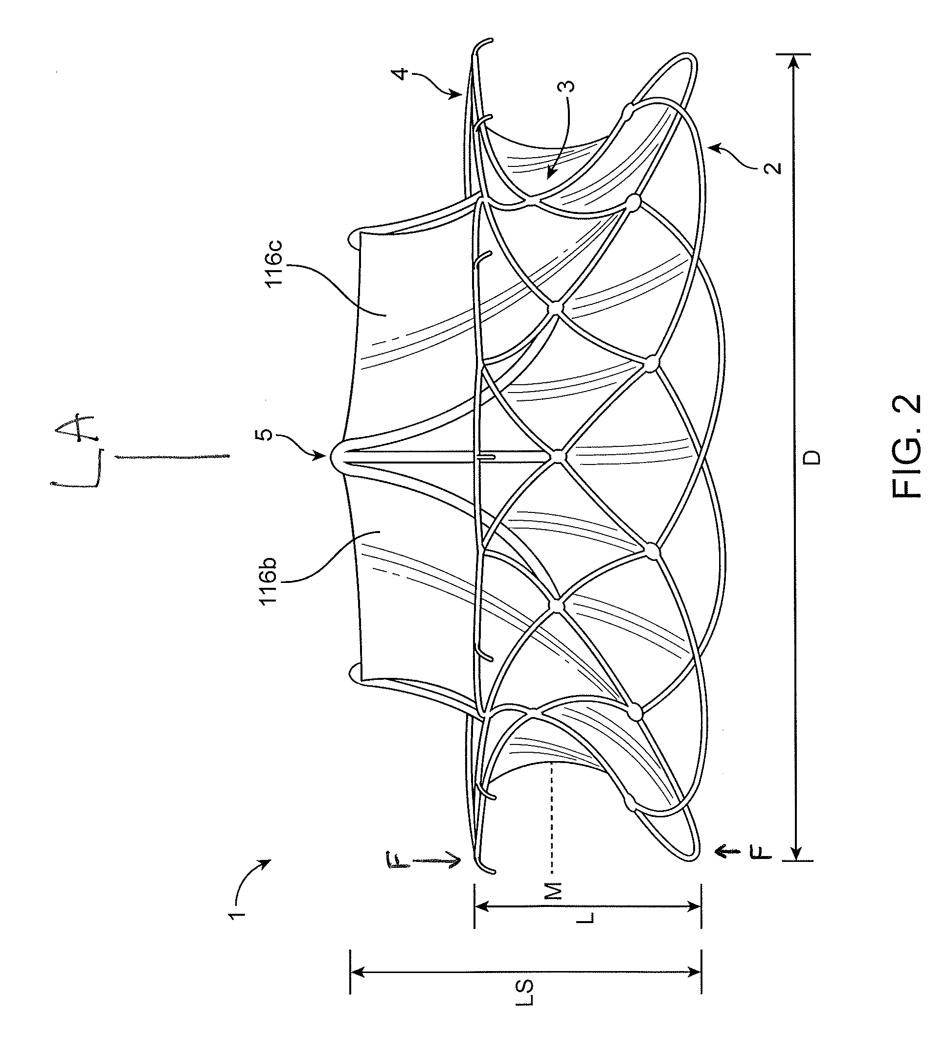 Replacement cardiac valves and methods of use and manufacture