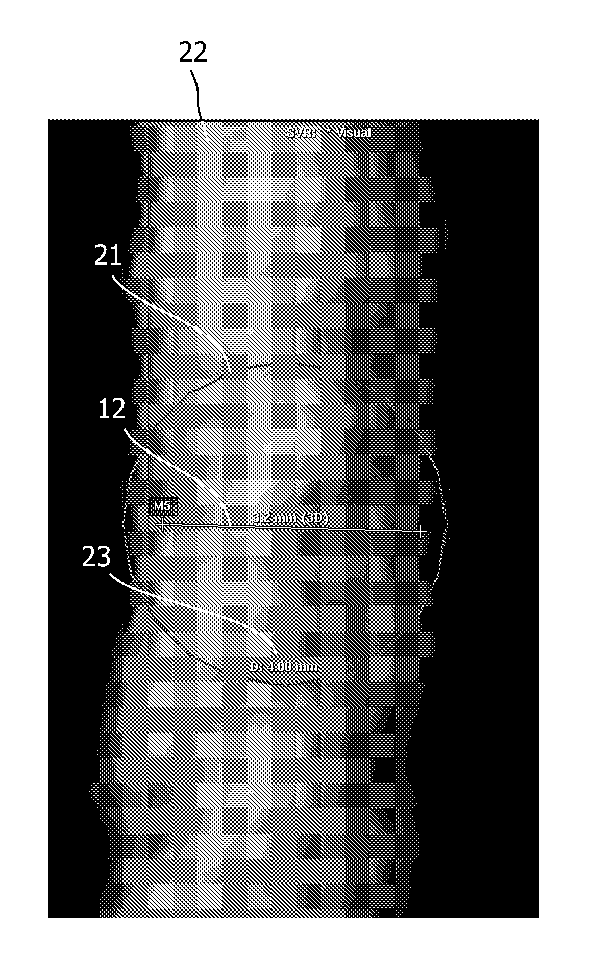 Caliper for measuring objects in an image