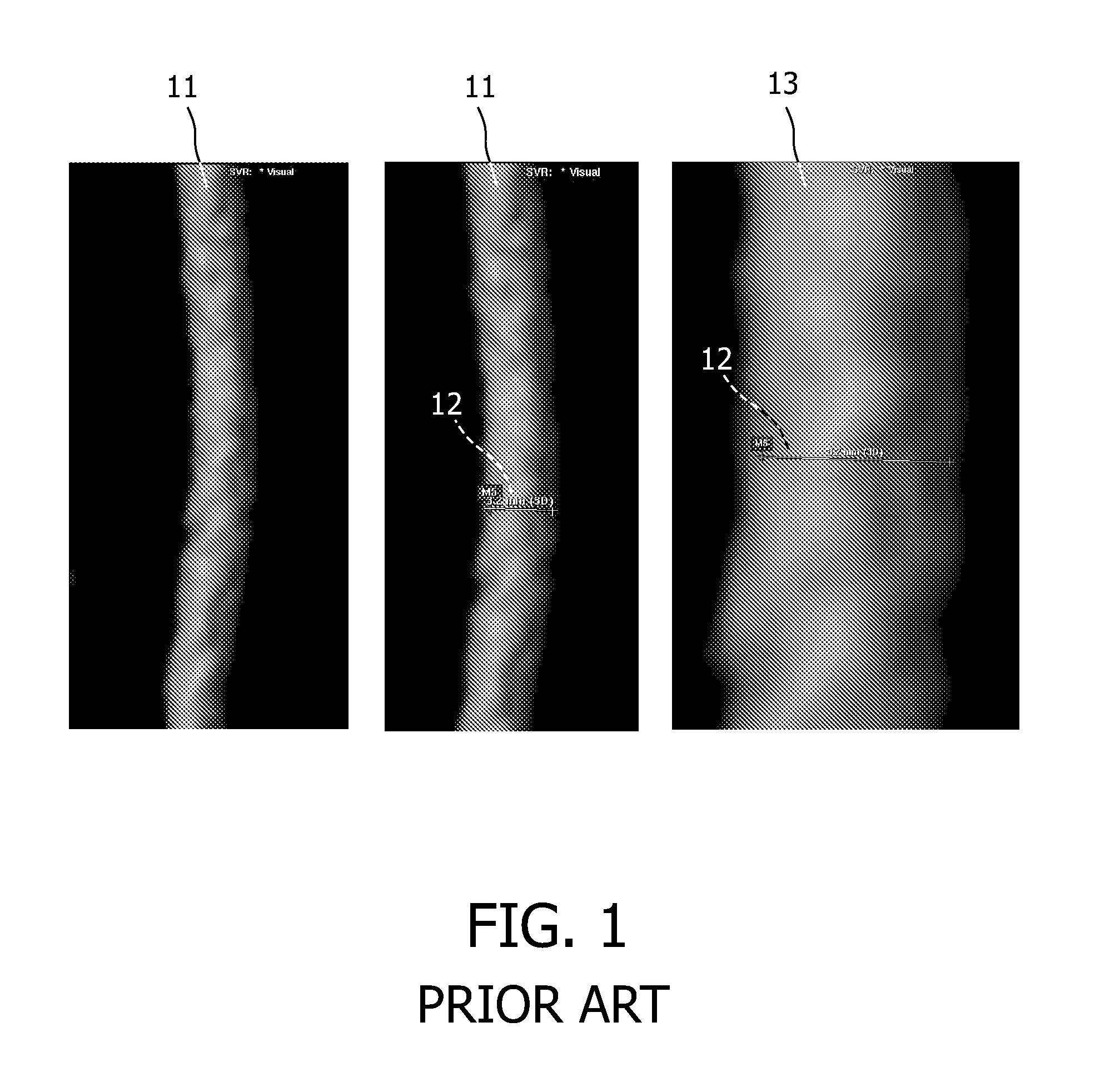 Caliper for measuring objects in an image