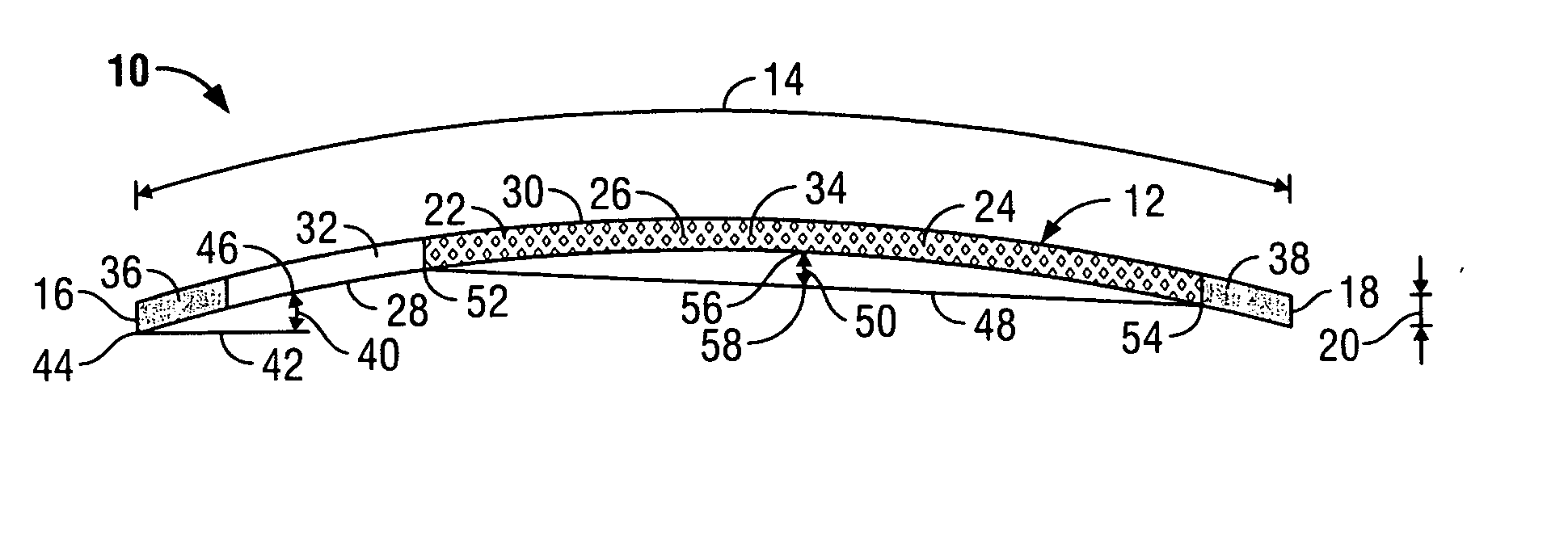 Dental finishing device