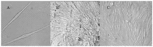 A Simple Isolation and Identification Method of Human Placental Myofibroblasts