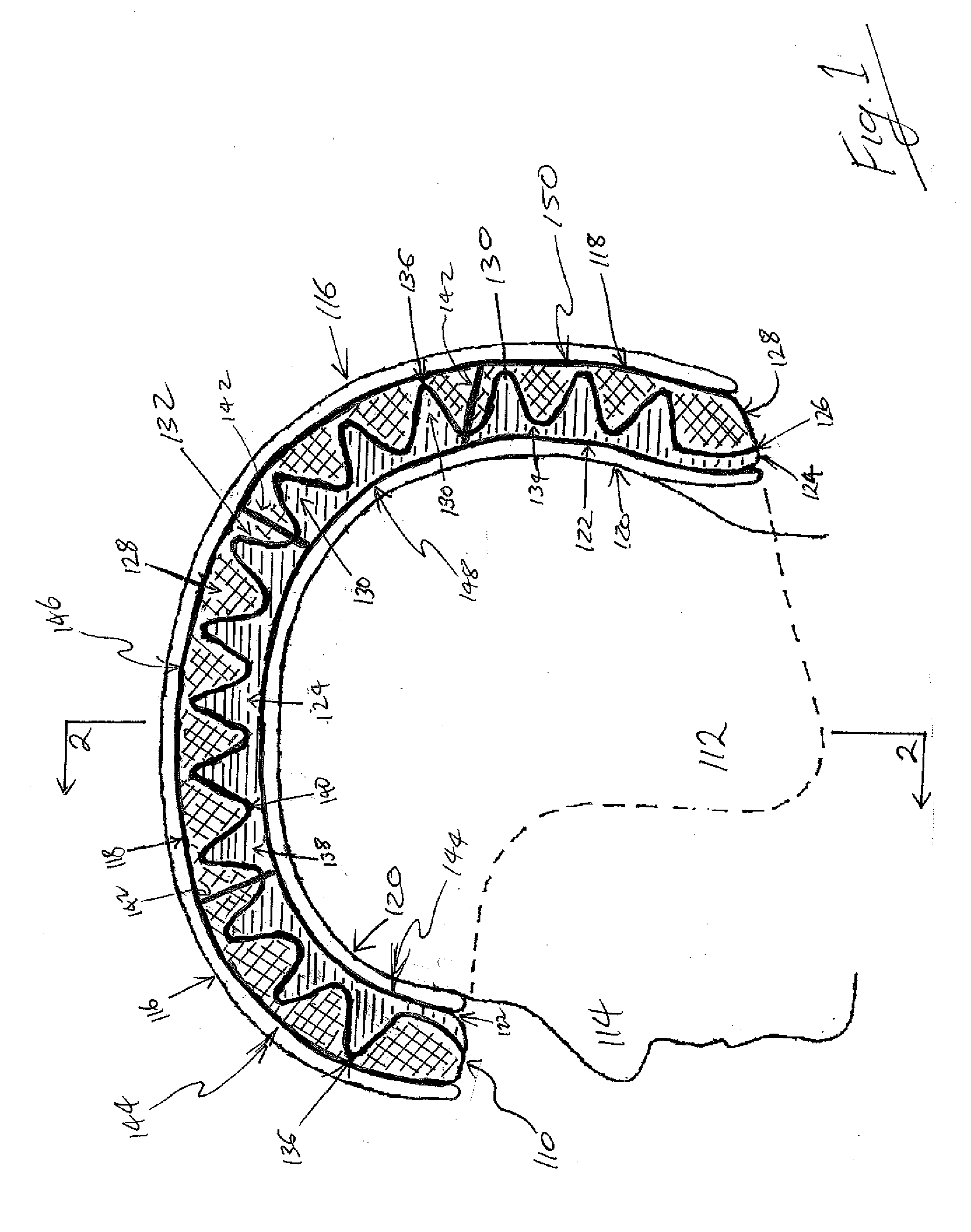 Compressible Liner for Impact Protection