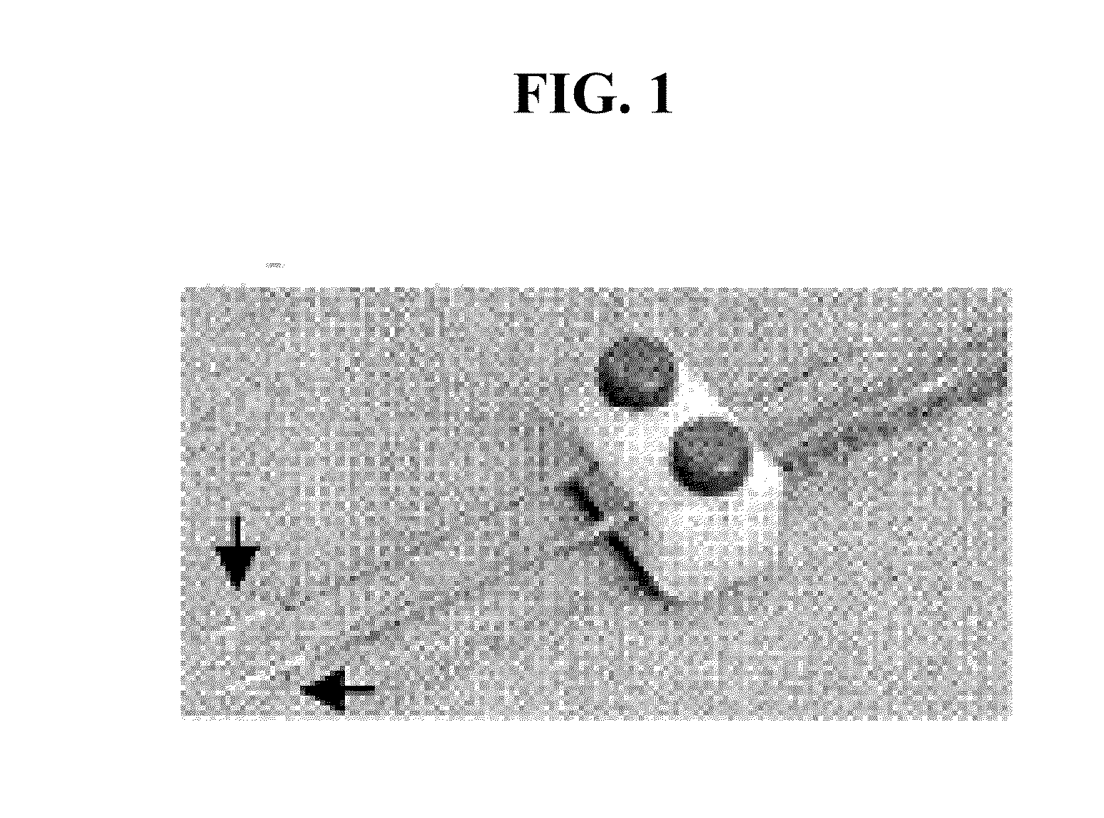 Devices for material delivery, electroporation, sonoporation, and/or monitoring electrophysiological activity
