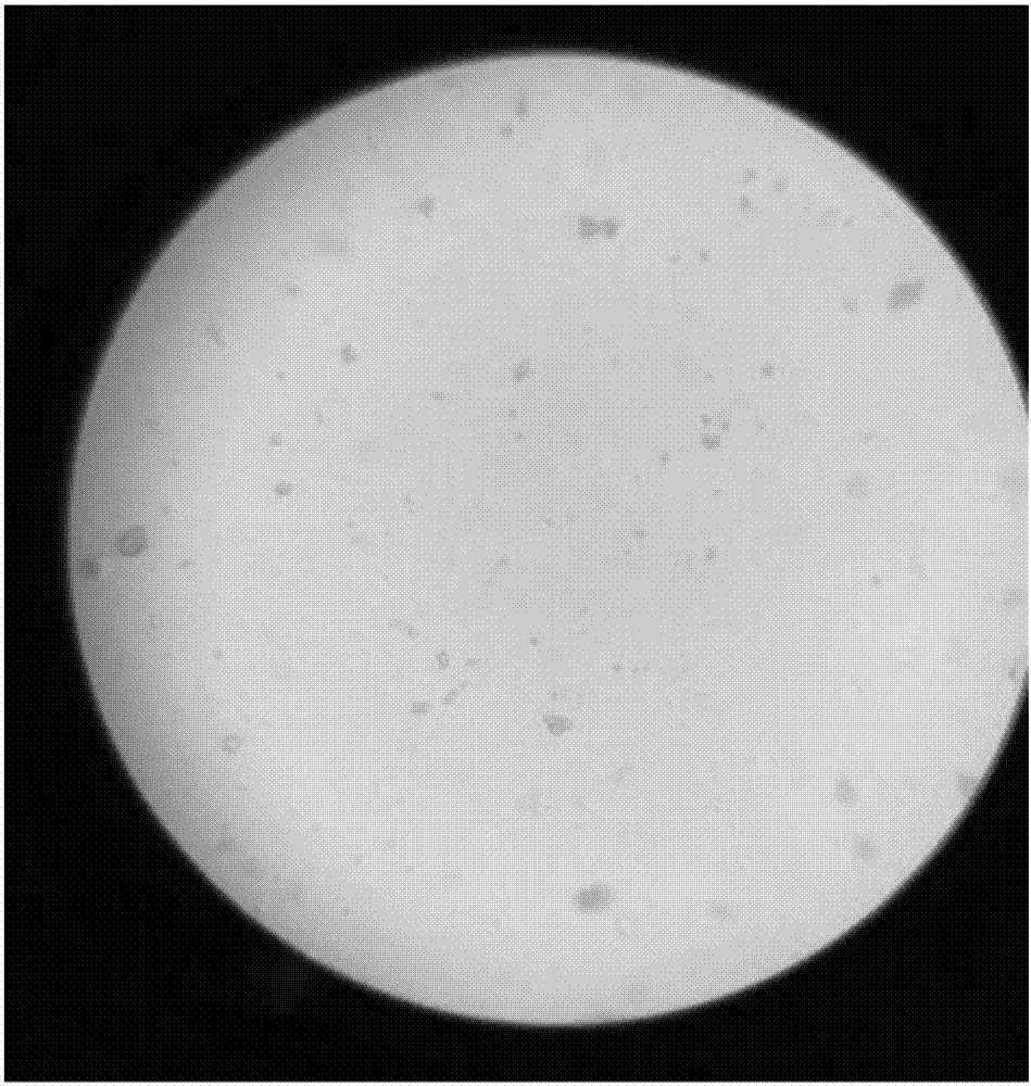 Whole-nutritive special medical emulsion and preparation method thereof