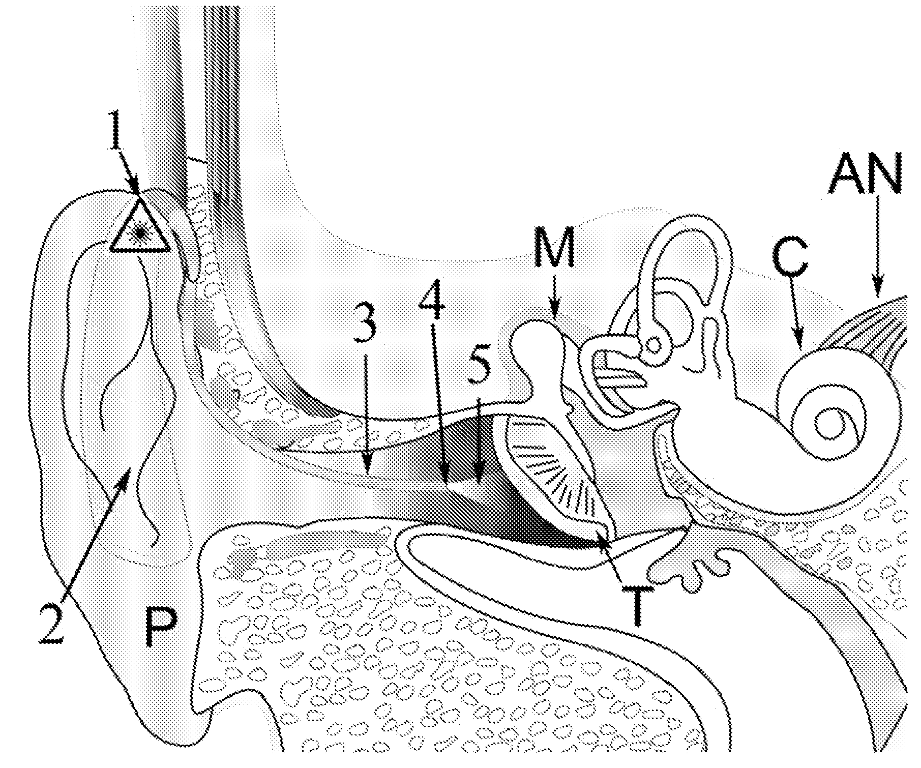 Light activated hearing aid device