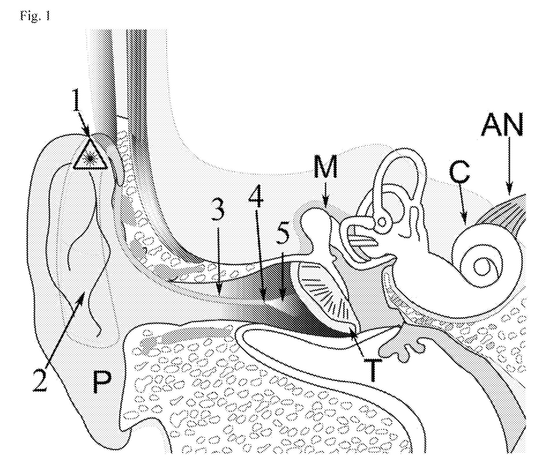 Light activated hearing aid device