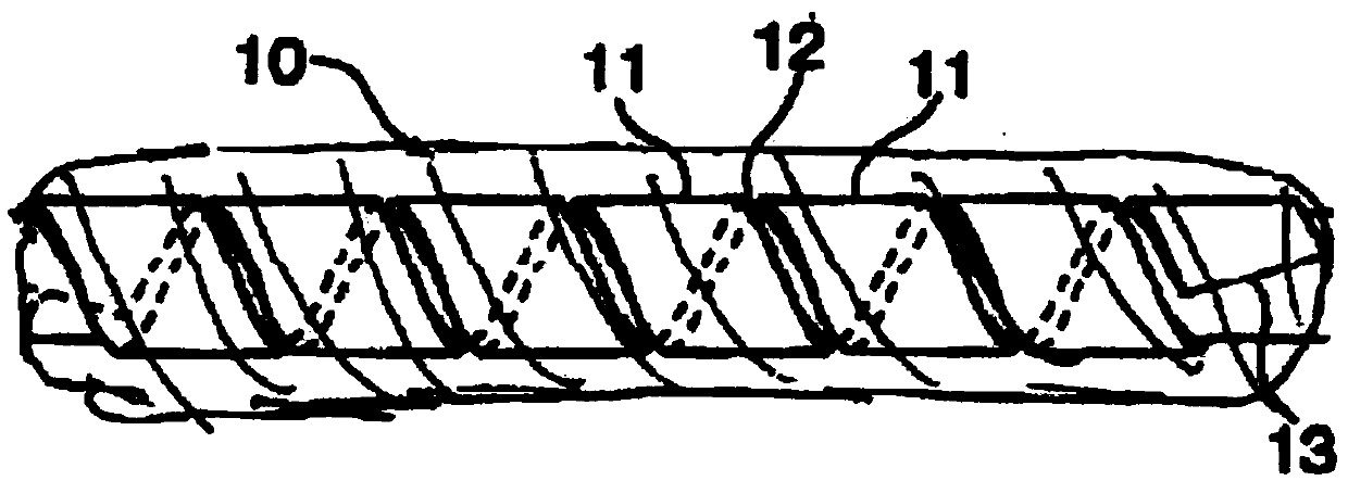 Helical hybrid stent