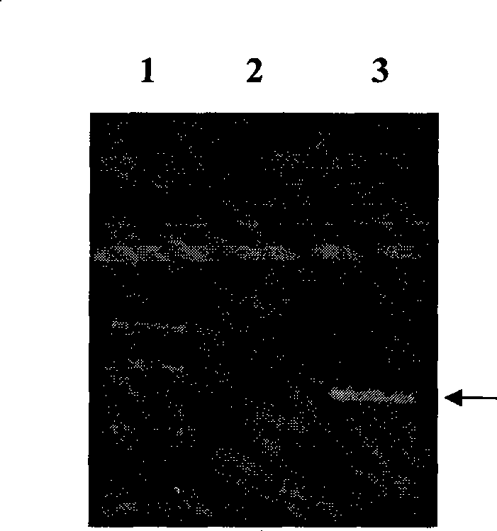 Lung cancer DNA plasmid vaccine and preparation method thereof