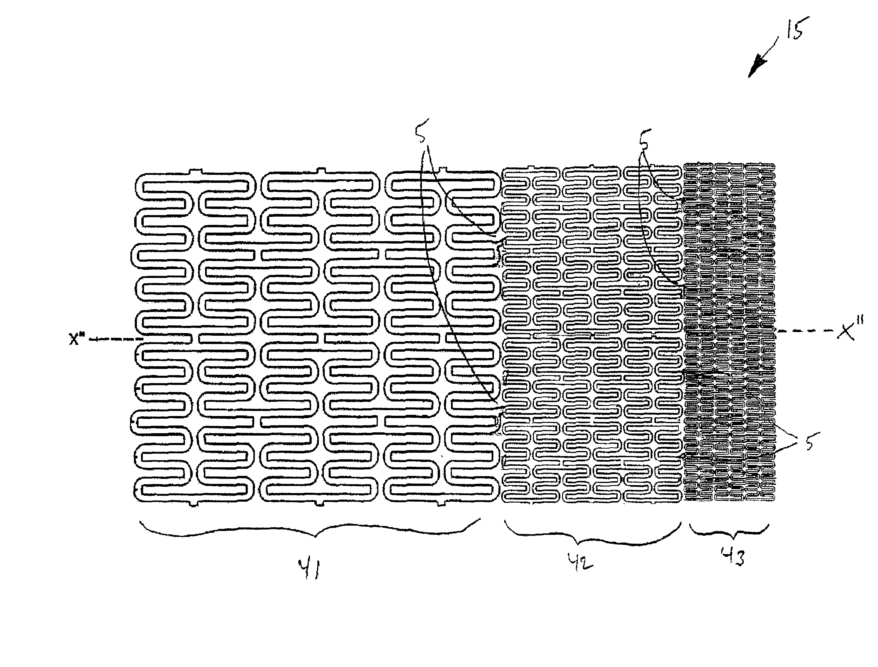 Stent and stent delivery system for ostial locations in a conduit