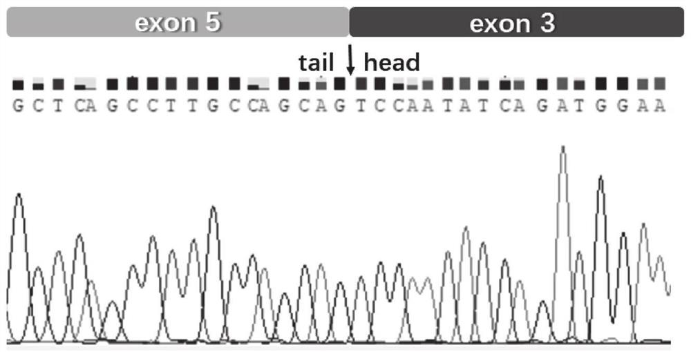 A molecular biomarker for the diagnosis and treatment of triple-negative breast cancer and its application