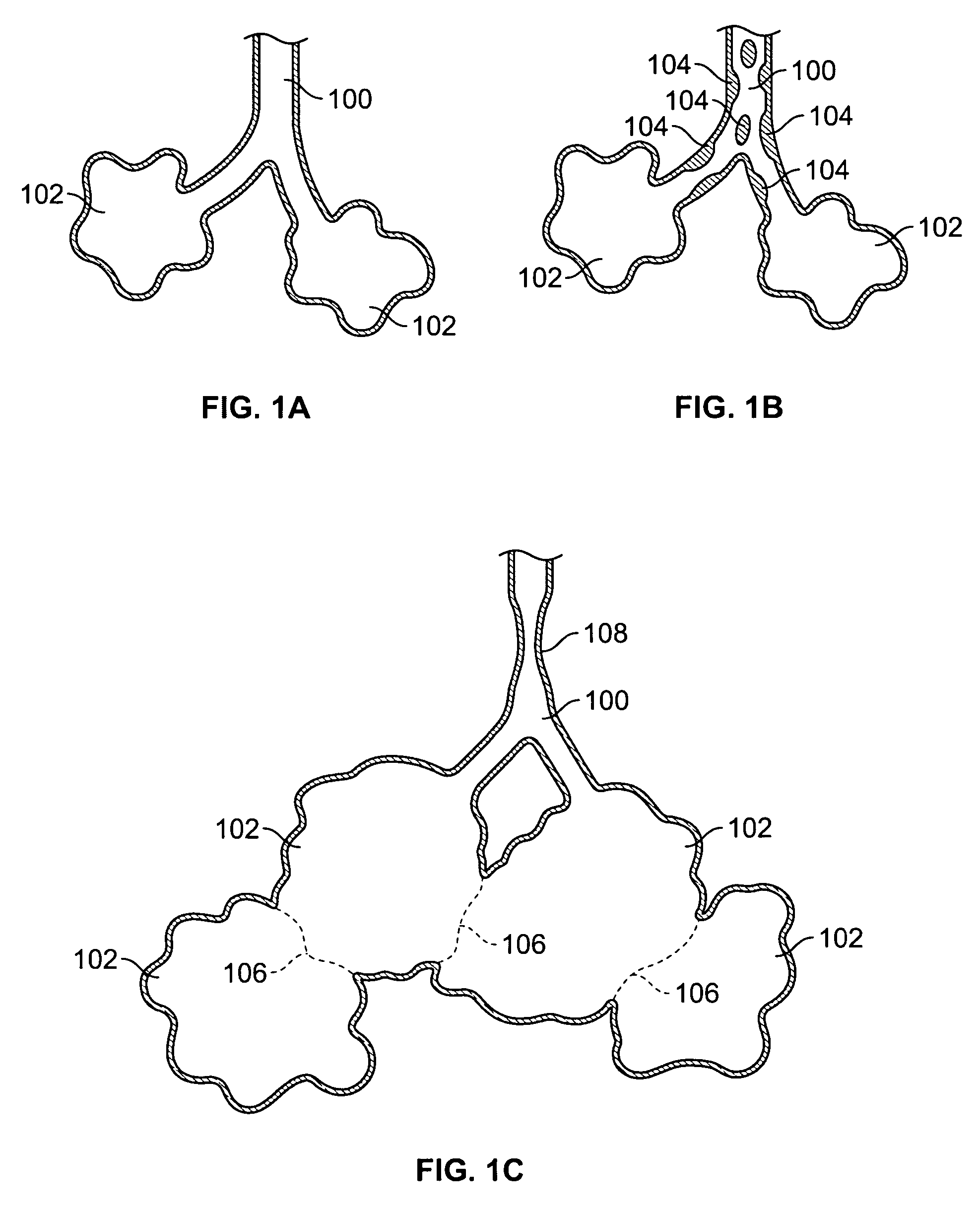 Methods and devices for maintaining patency of surgically created channels in a body organ