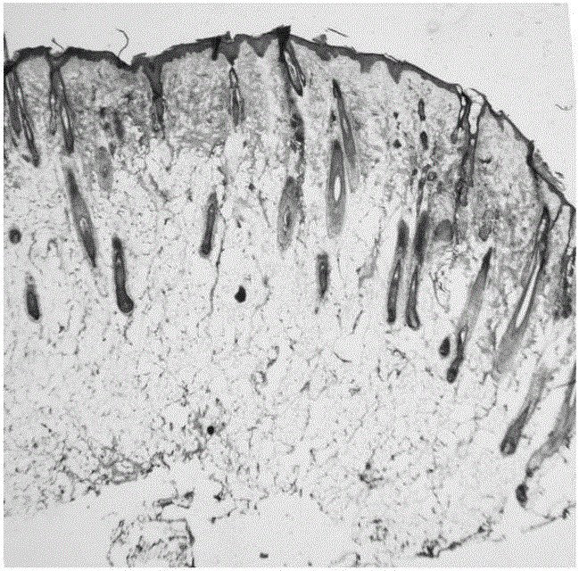 A kind of tissue engineering epidermis and preparation method thereof