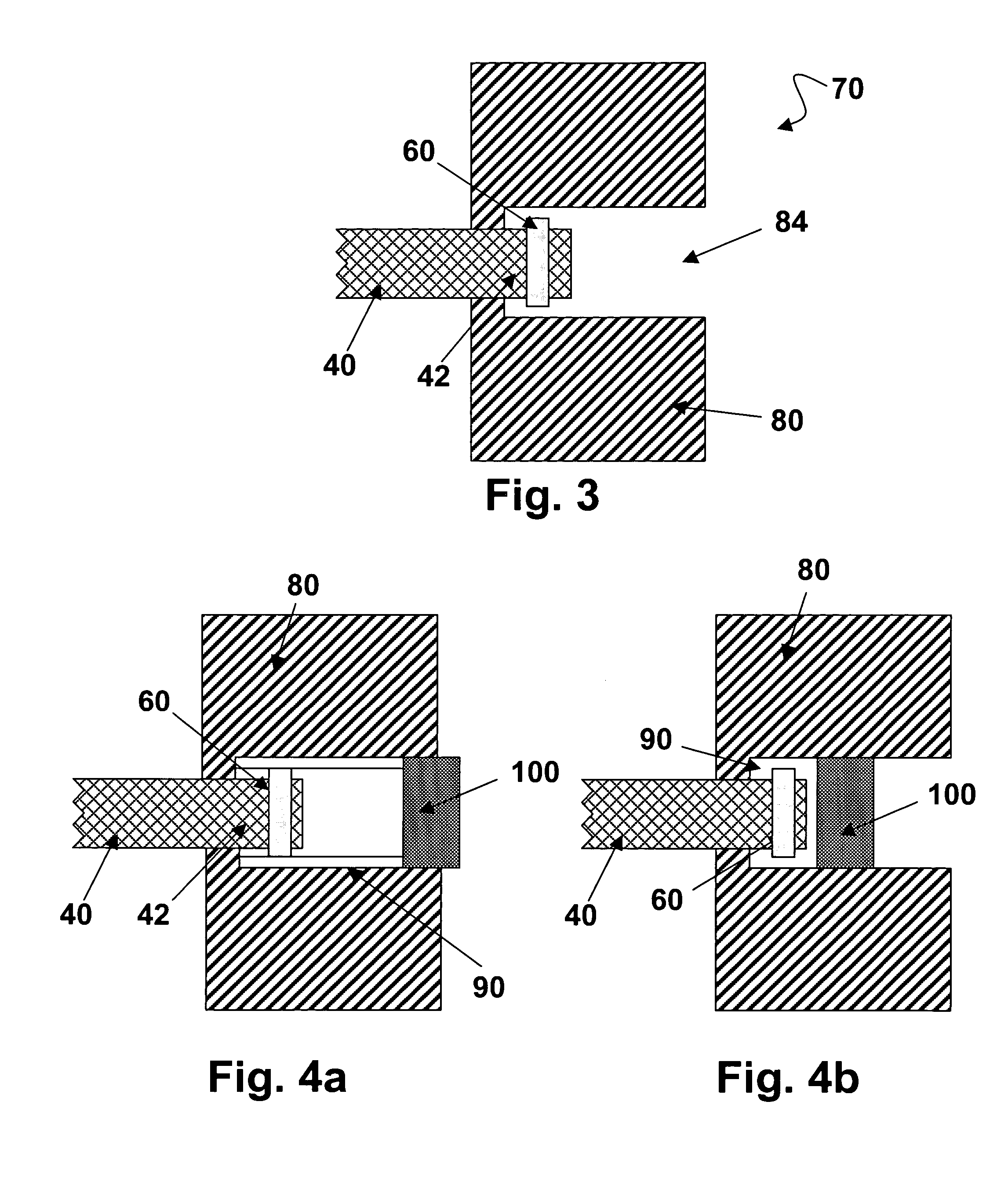 Tissue repair device and fabrication thereof