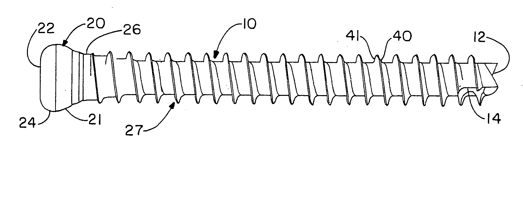 Orthopedic screw for use in repairing small bones