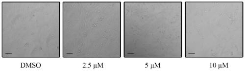 Application of Cynanoside H in preparation of drug for preventing and treating breast cancer