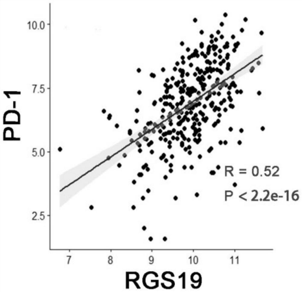 Application of RGS19 in construction of lung squamous cell carcinoma prognosis prediction model as diagnostic marker