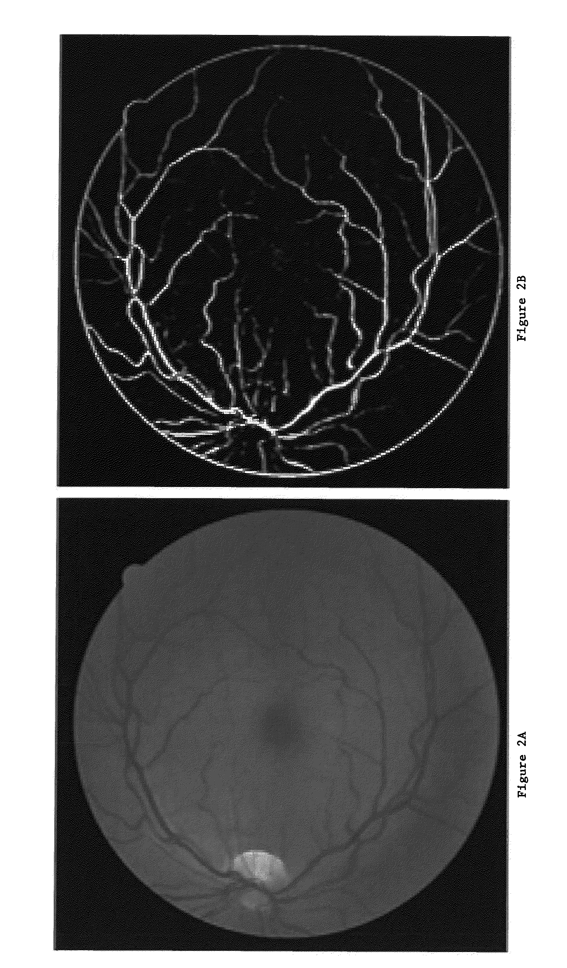 Alpha-matting based retinal vessel extraction