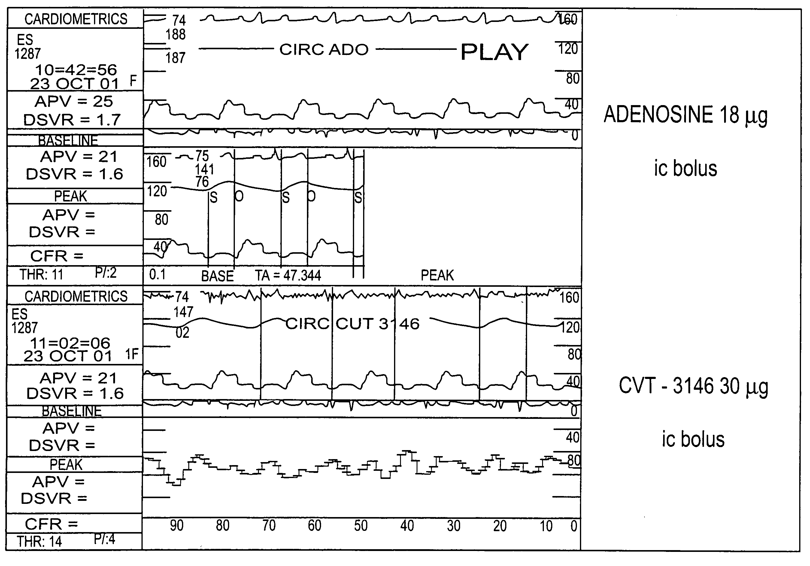 Myocardial perfusion imaging methods and compositions