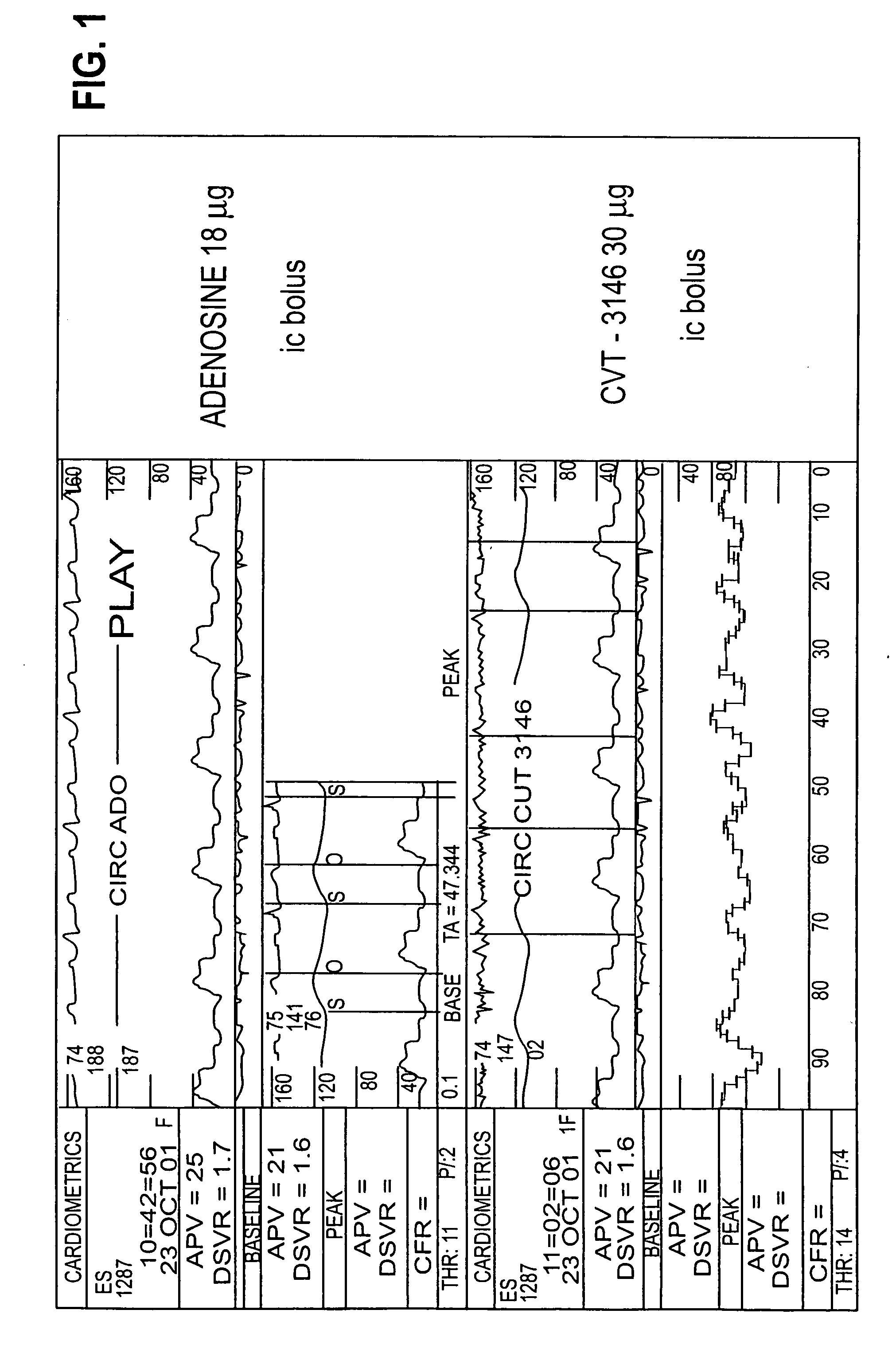 Myocardial perfusion imaging methods and compositions