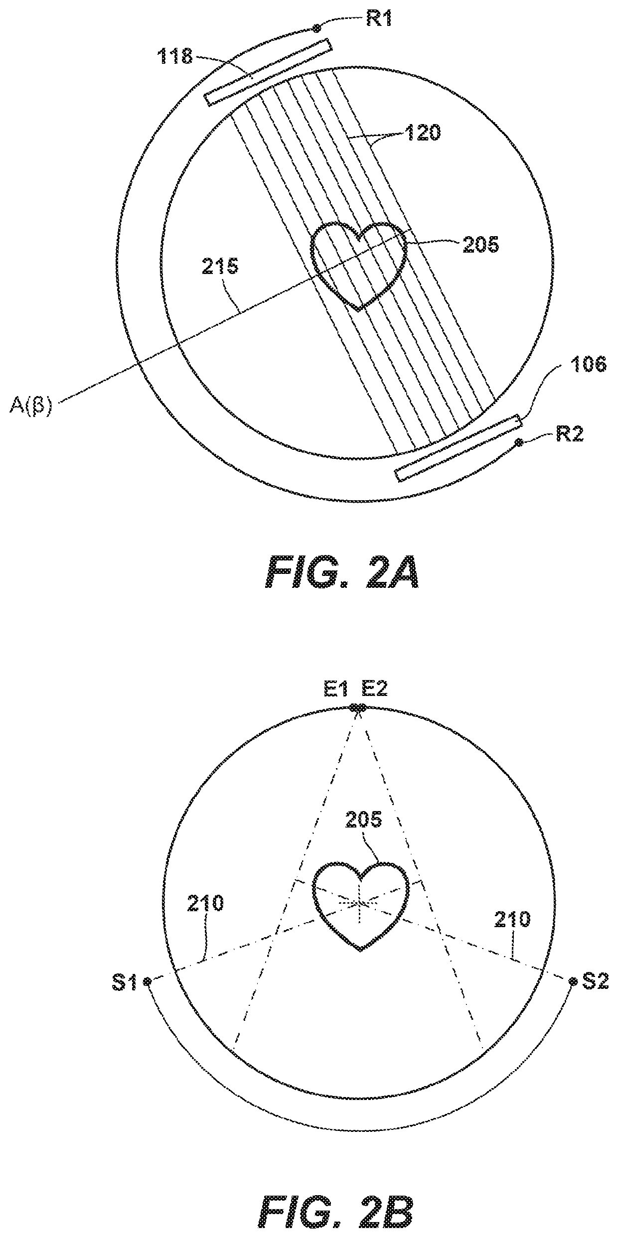 Automated phase selection for ecg-gated cardiac axial ct scans