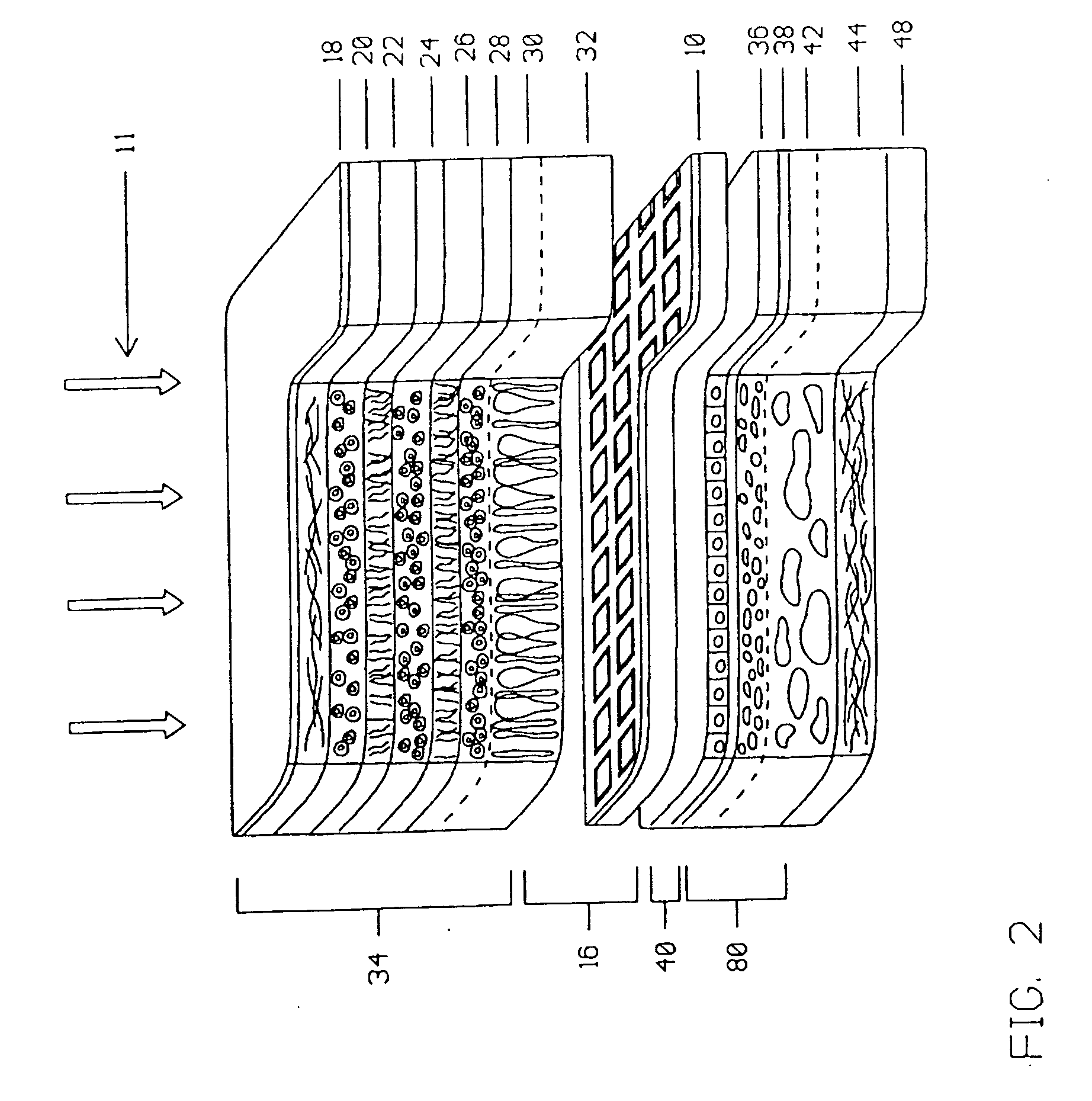 Multi-phasic microphotodetector retinal implant with variable voltage and current capability and apparatus for insertion