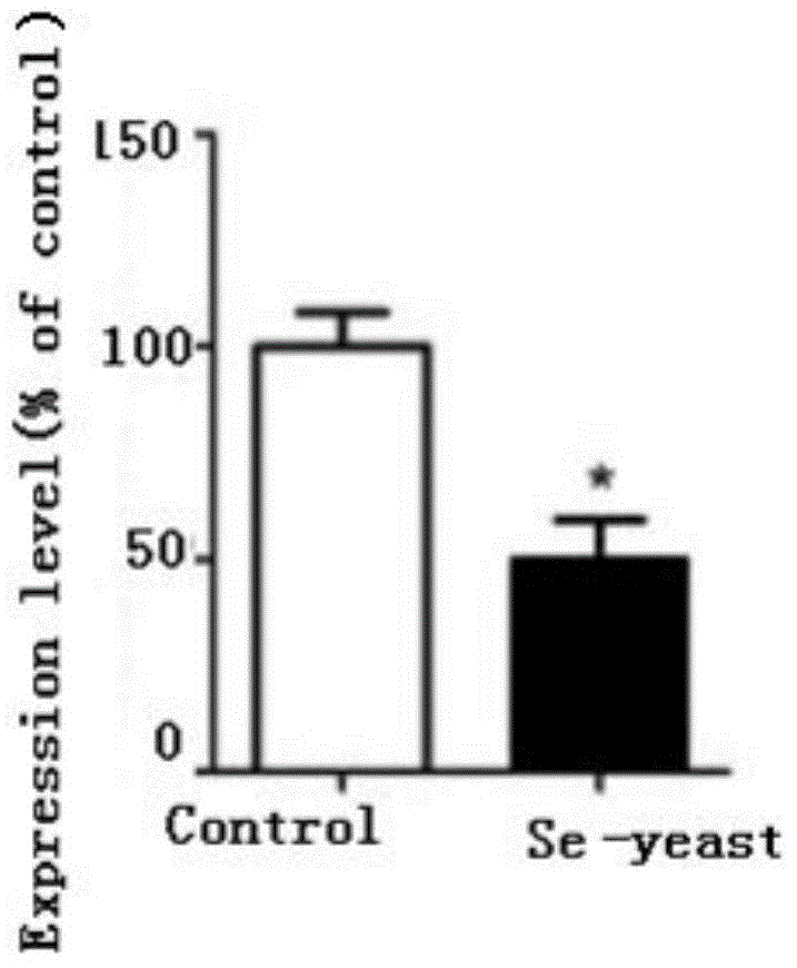 Application of selenium enriched yeast in control of Alzheimer disease