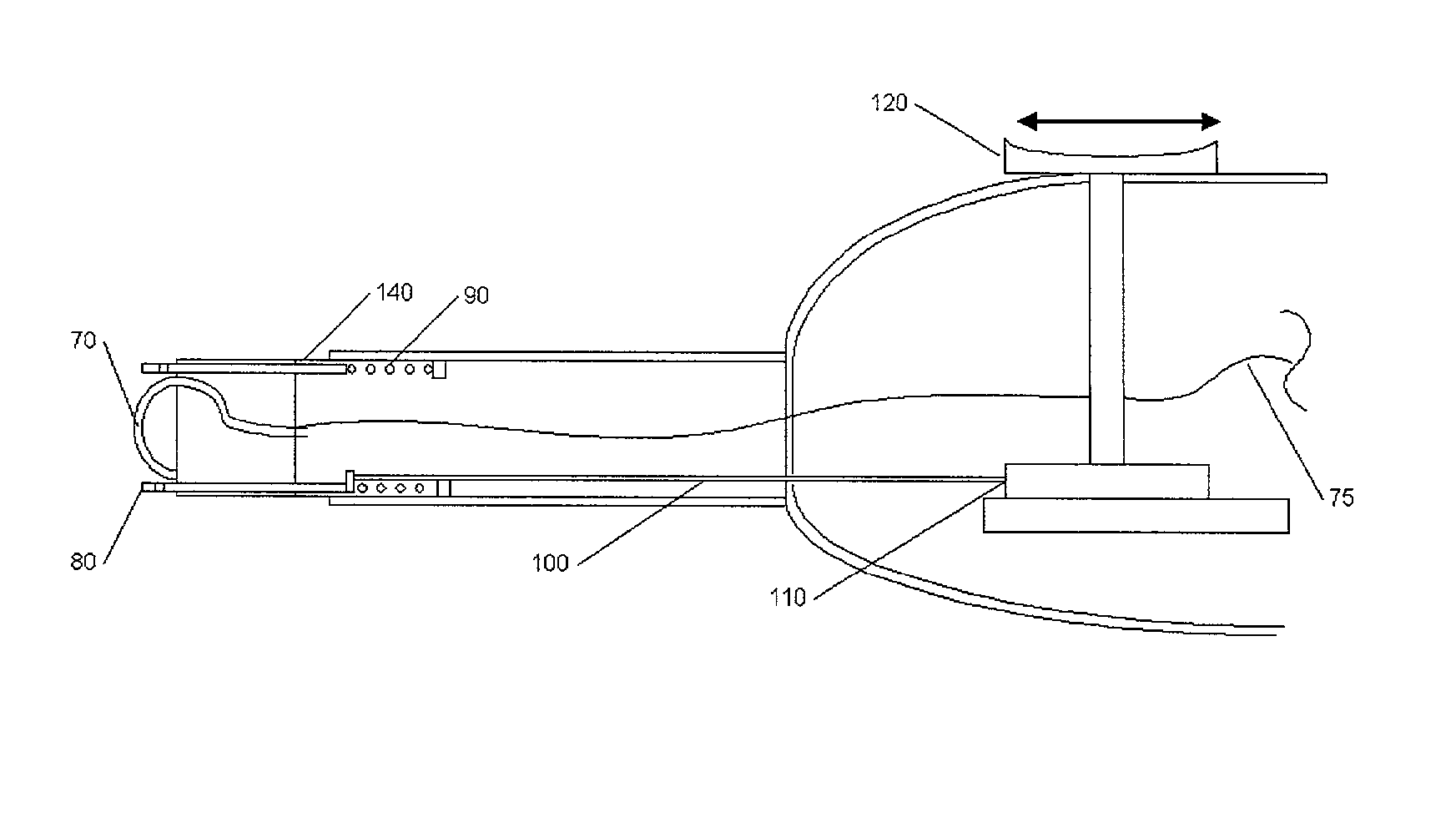 Methods and devices for electrosurgery