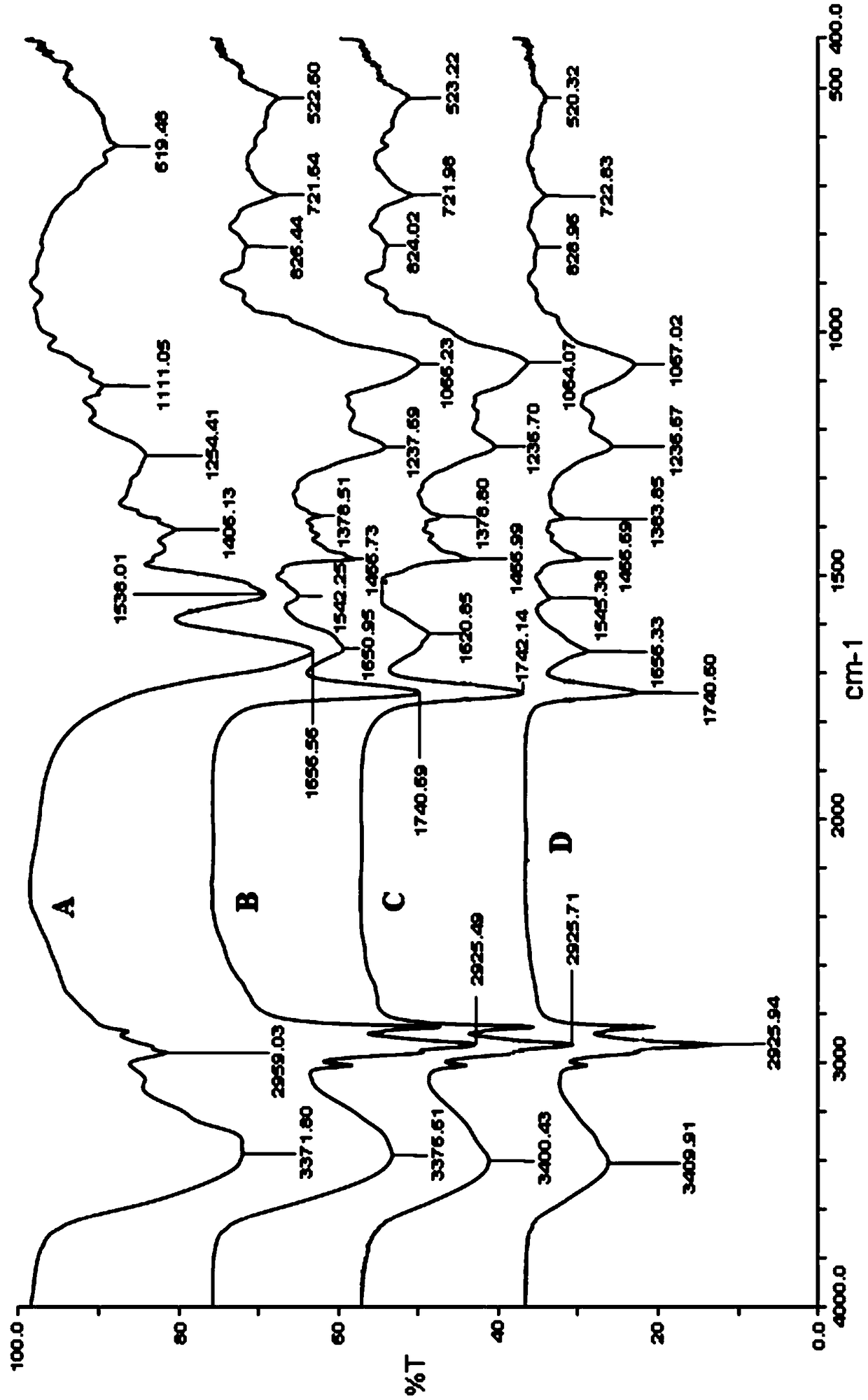 Salmon calcitonin phospholipid complex, its lipid nanoparticles and preparation method