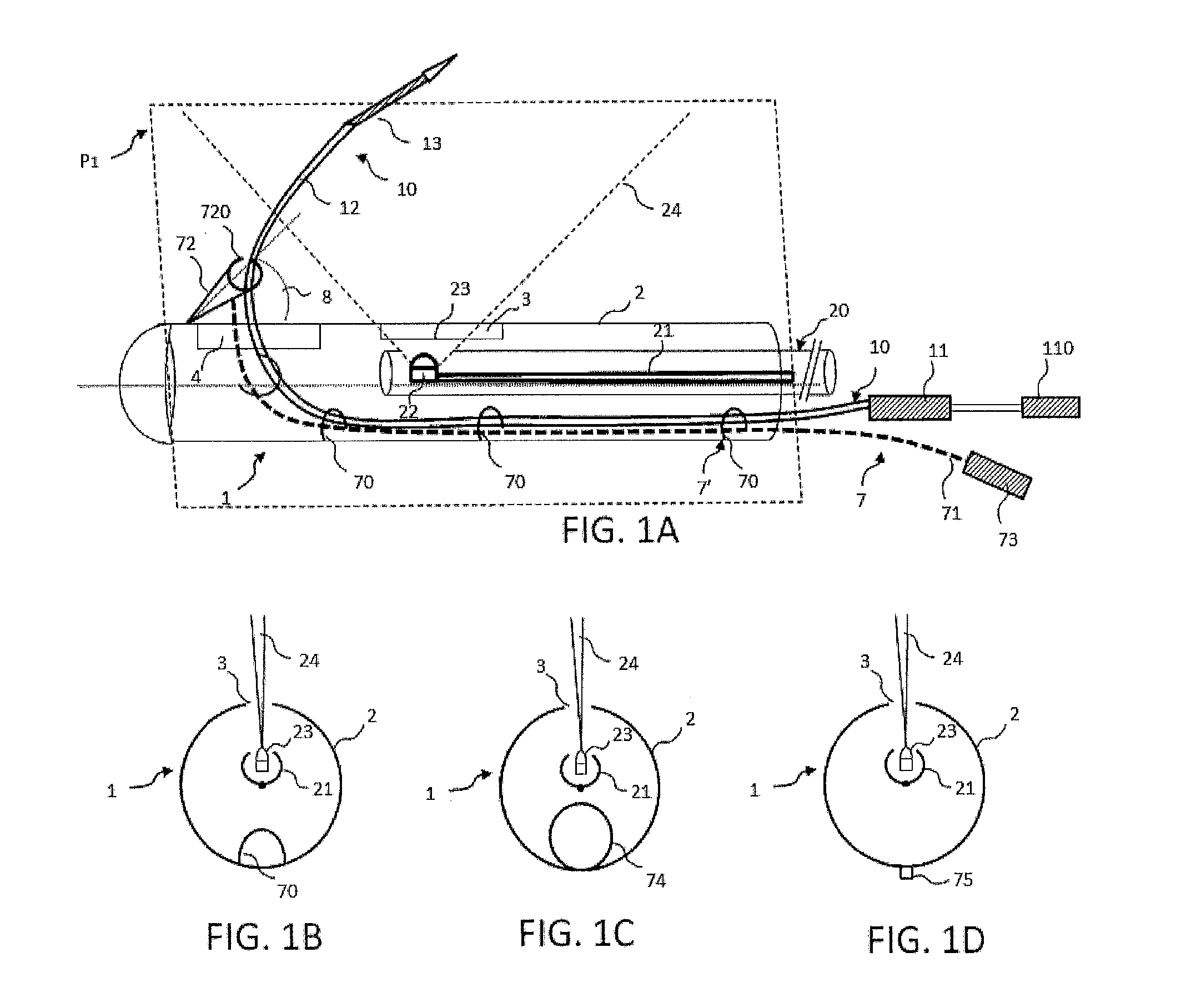 Catheter and associated methods