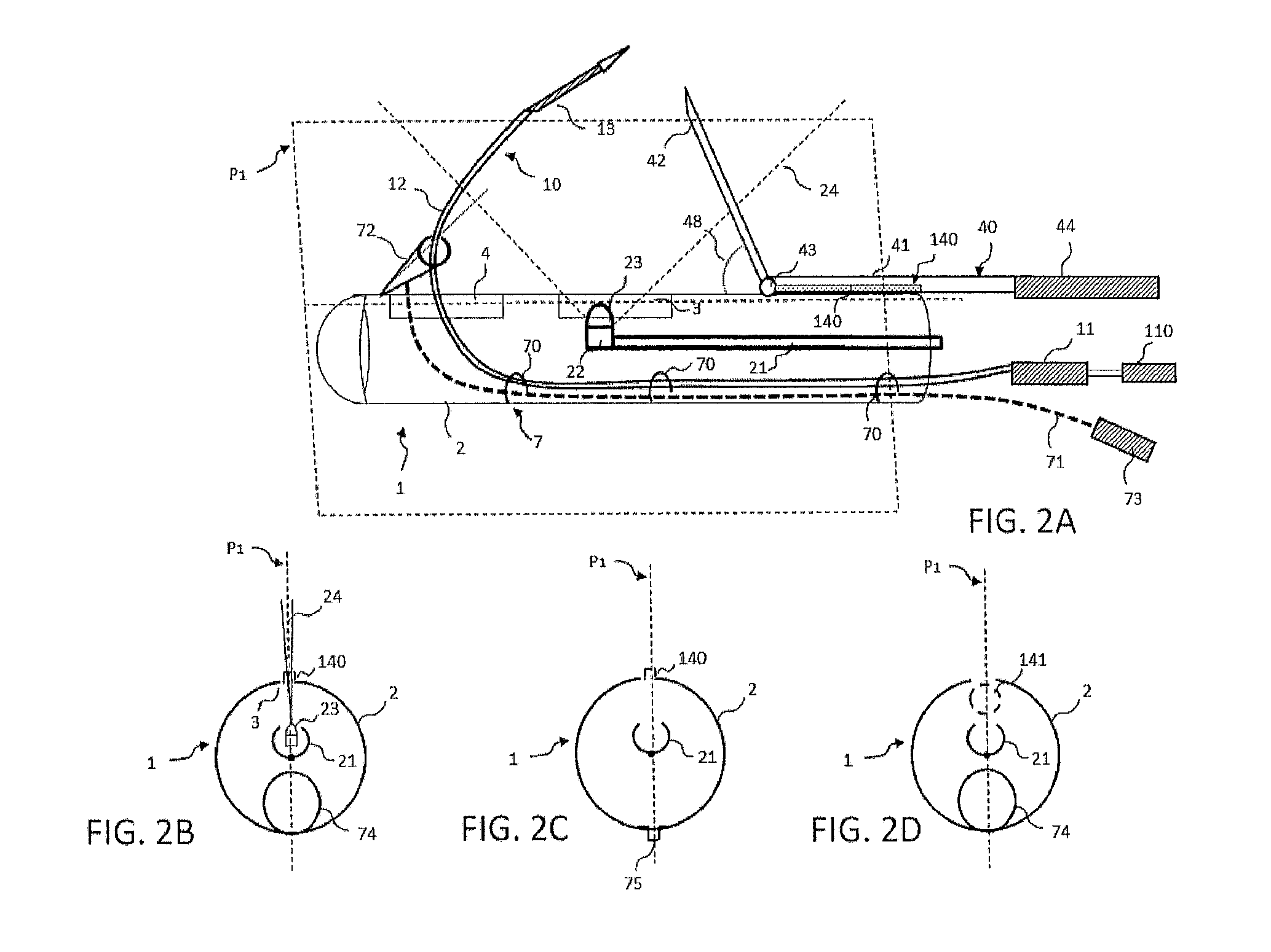 Catheter and associated methods