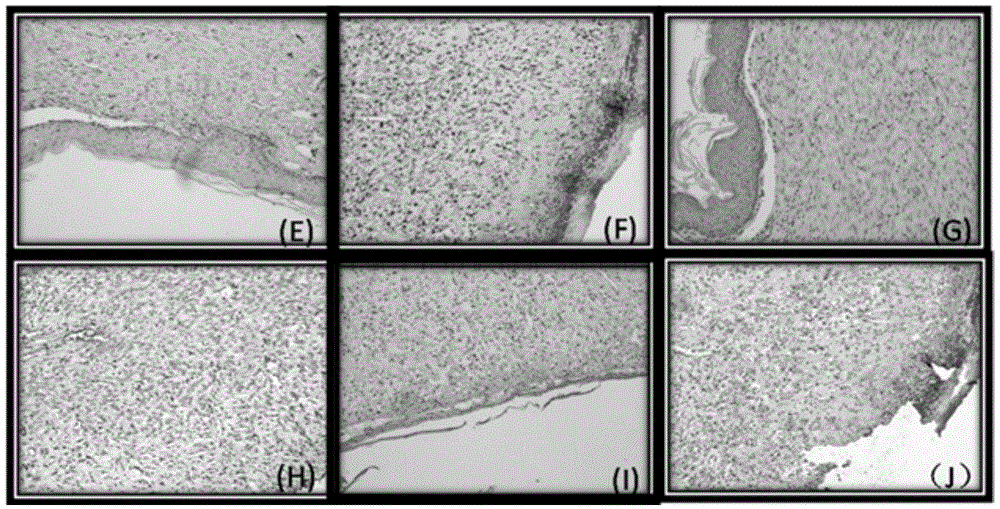 Water-soluble gel for treating diabetic foot