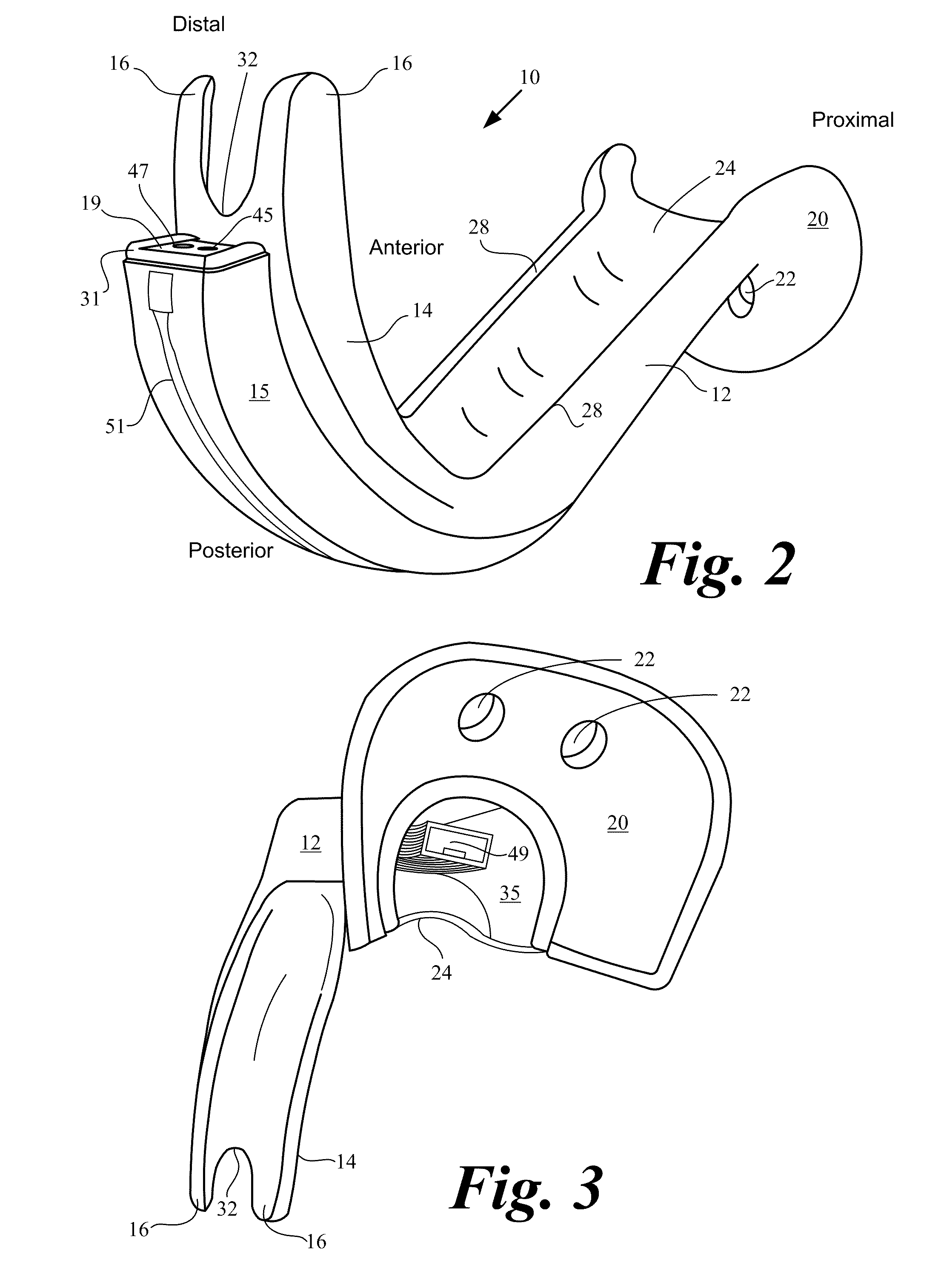 Channel laryngoscopes and systems