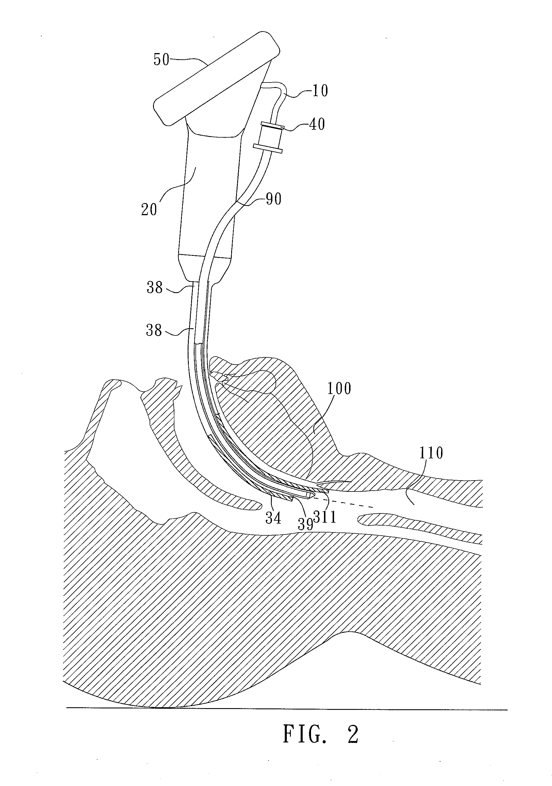 Tracheal Intubation Device