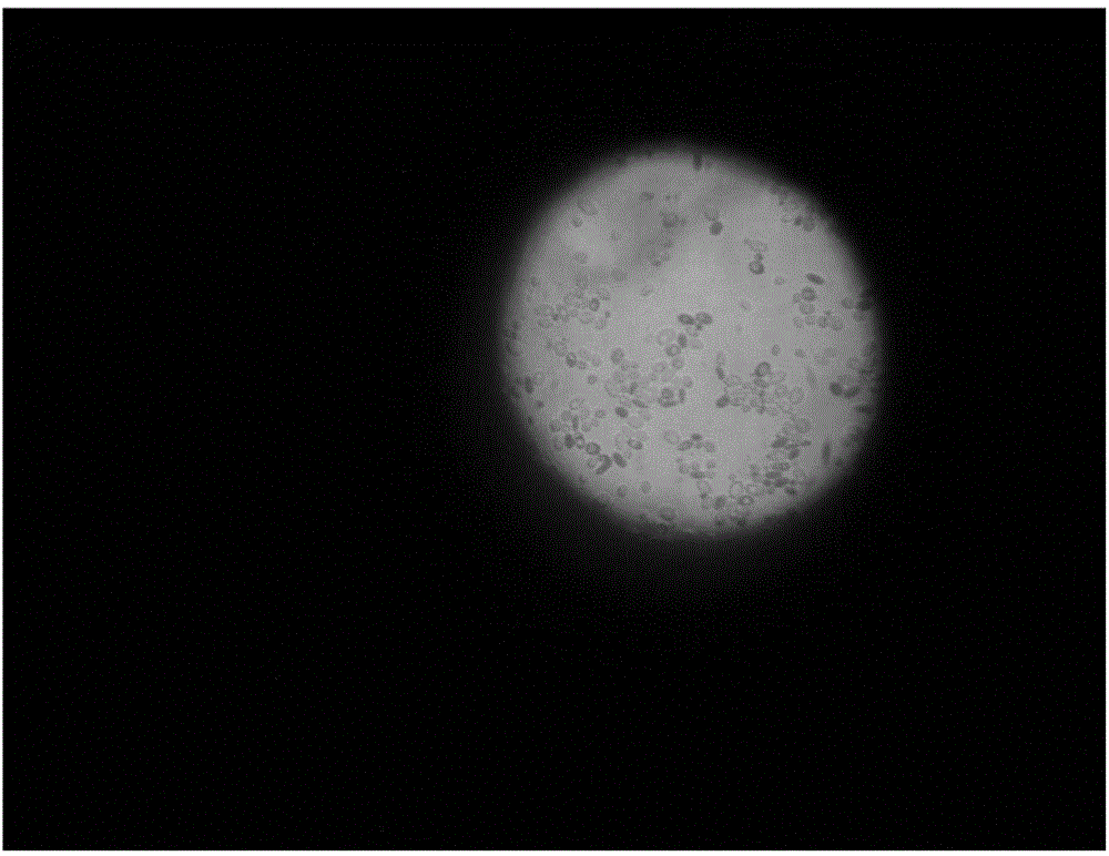 Saccharomyces cerevisiae and application thereof