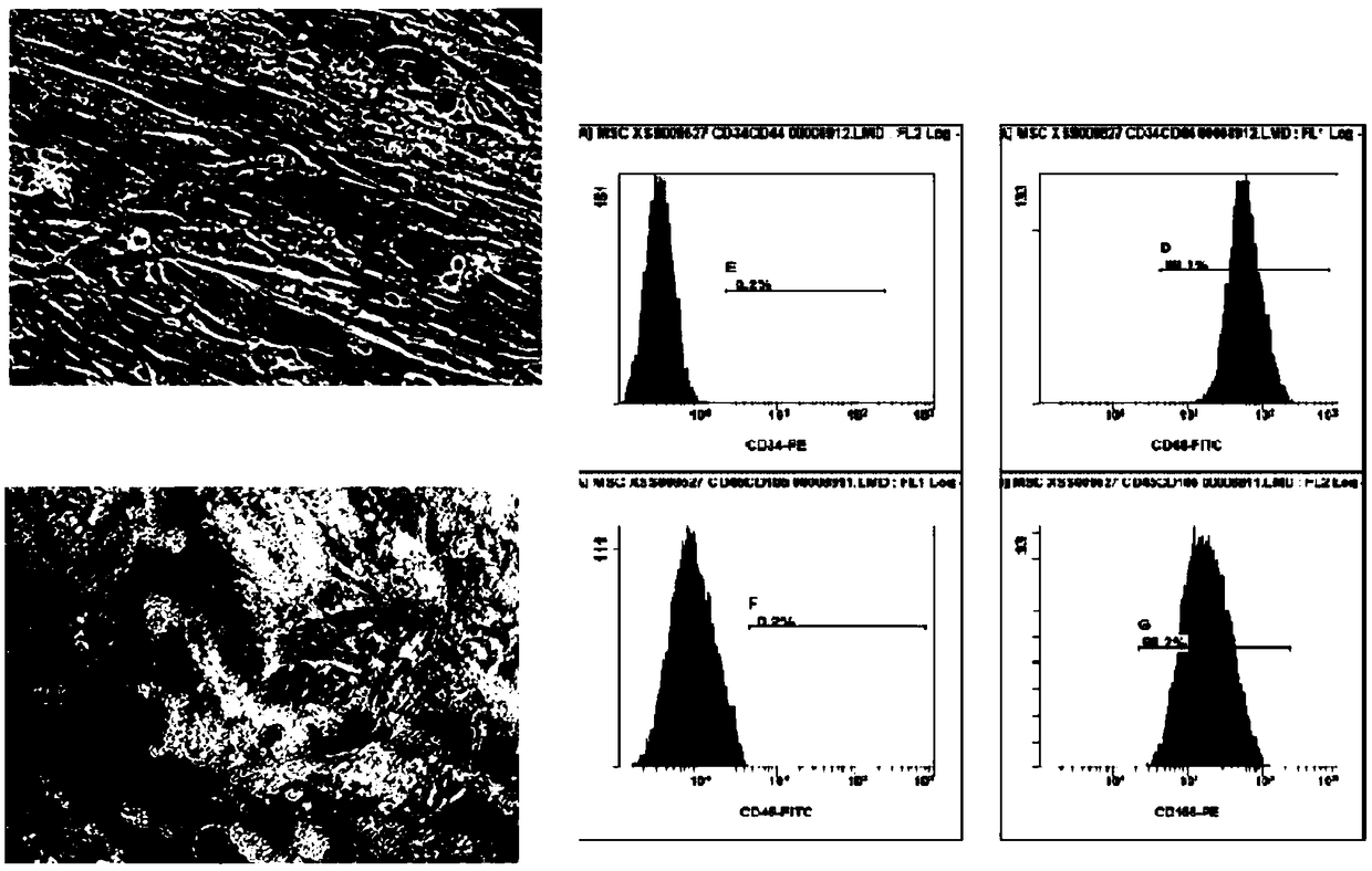 Preparation and cryopreservation method and application of human placental chorionic tissues