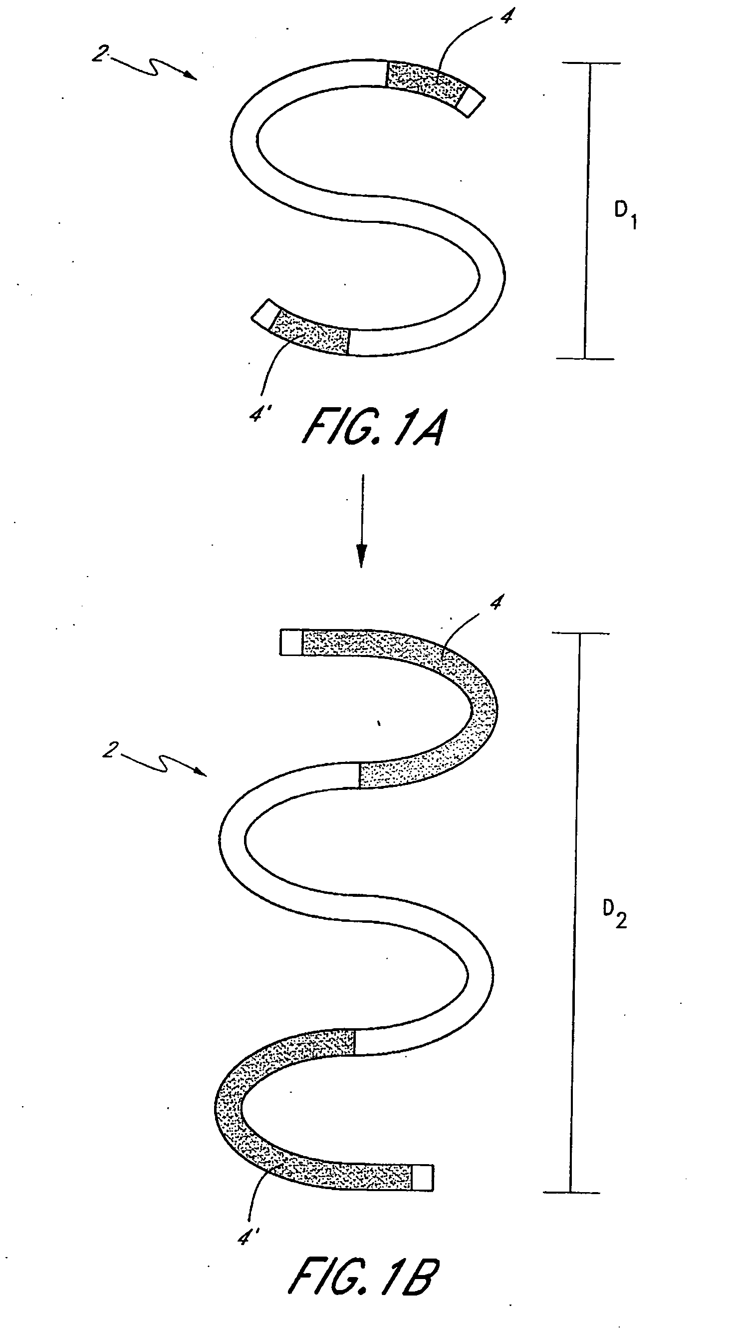 Adjustable embolic aneurysm coil