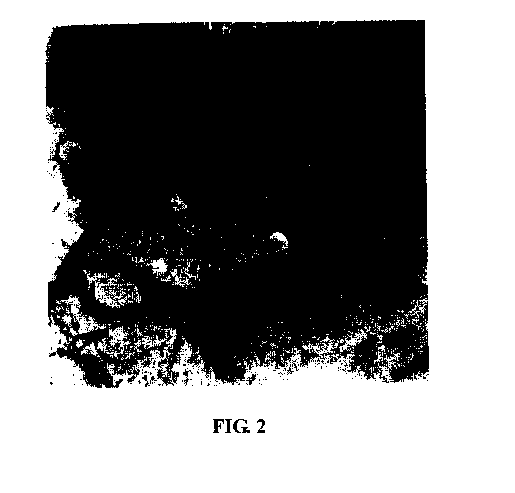 Medicament and method for treating recurrent spontaneous abortion