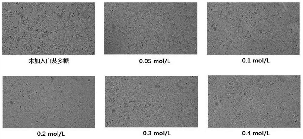 Method for preparing human Japanese encephalitis inactivated vaccine and vaccine