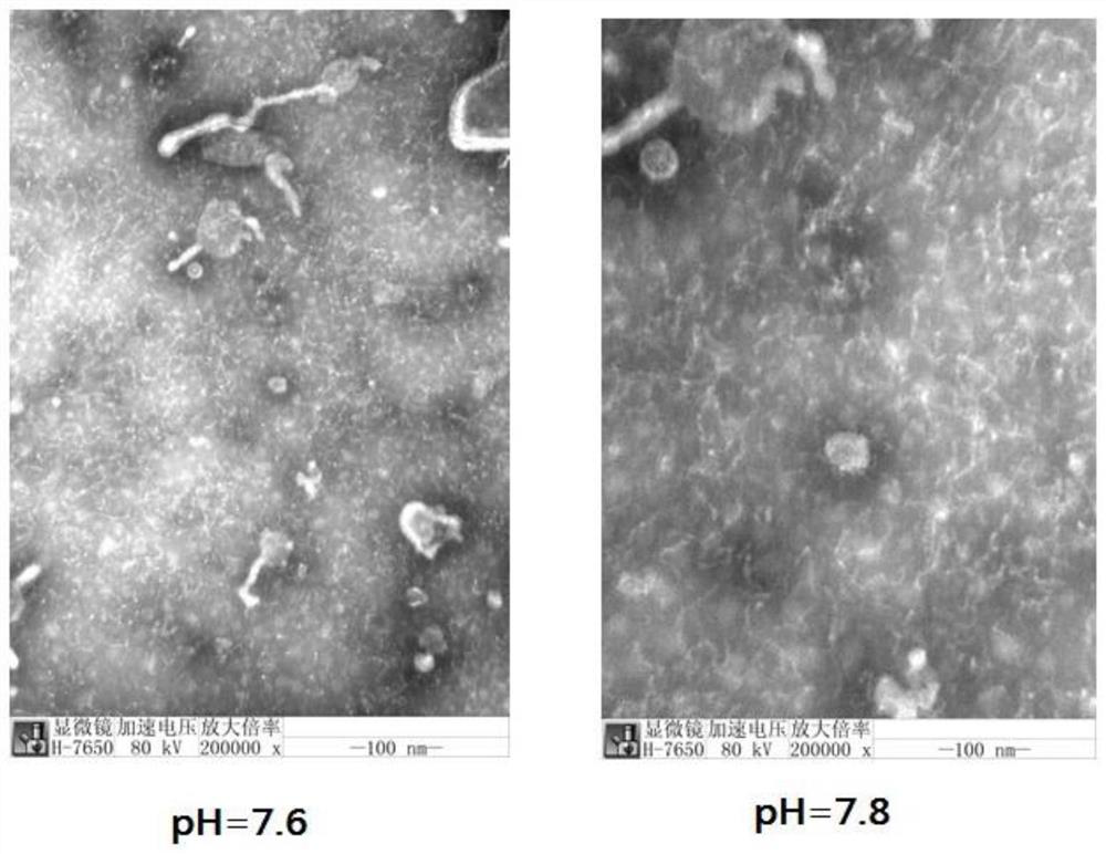 Method for preparing human Japanese encephalitis inactivated vaccine and vaccine