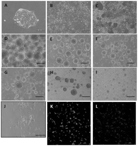 Application of recombinant human Notch1 protein in preparation of neural stem cells and cortical neurons