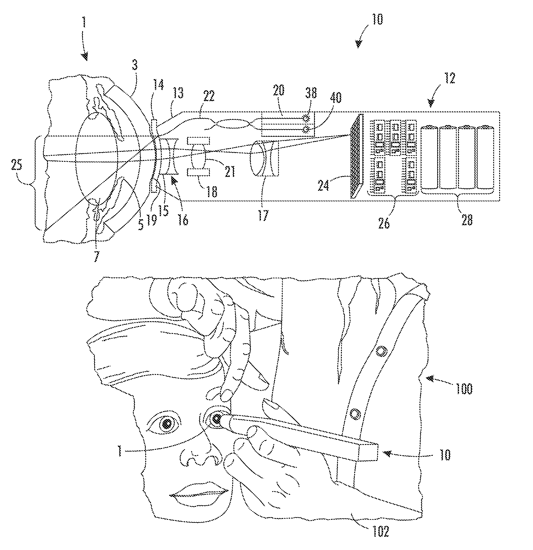 Portable fundus camera